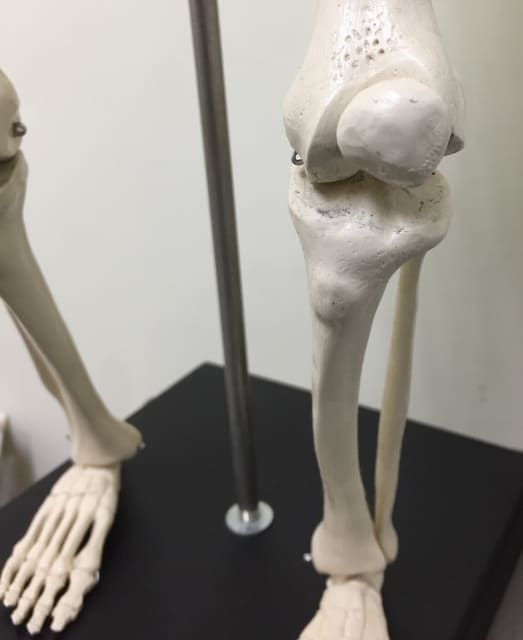 オスグット