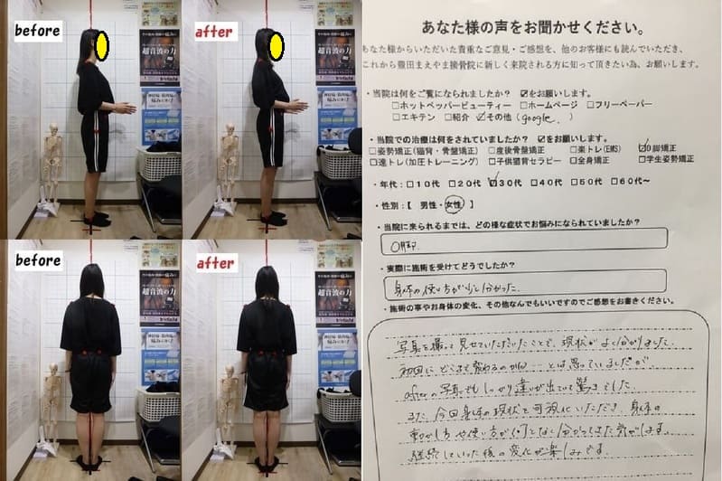 O脚　Ｏ脚矯正姿勢速圧プログラム（初回）