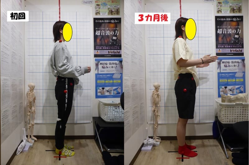 Ｏ脚矯正姿勢速圧プログラム