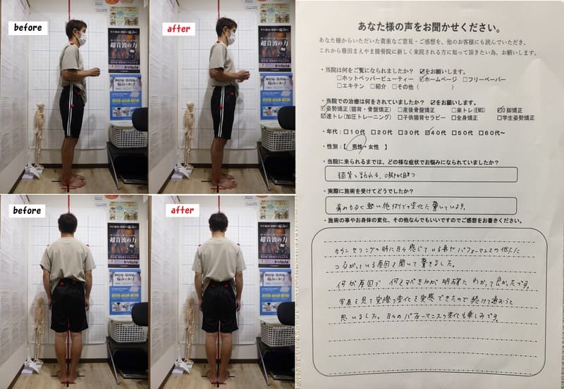 猫背　Ｏ脚が目立つ　O脚矯正姿勢速圧プログラムモニター（初回）