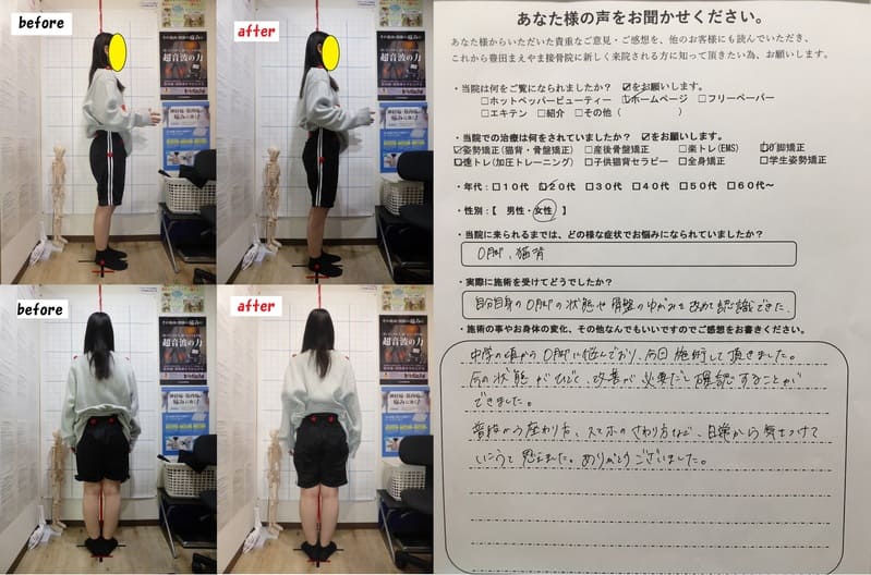 O脚　猫背　Ｏ脚矯正姿勢速圧プログラム（モニターキャンペーン）