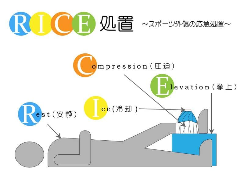 スポーツ外傷の処置
