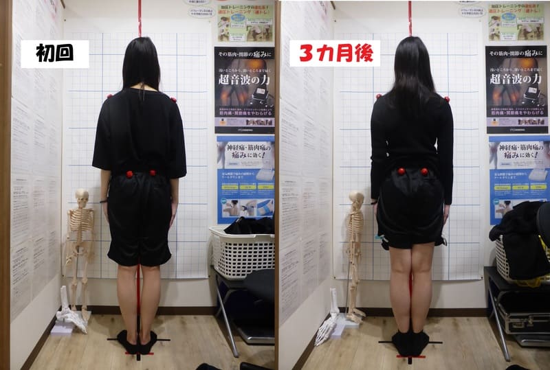 初回～３カ月後（後ろ）