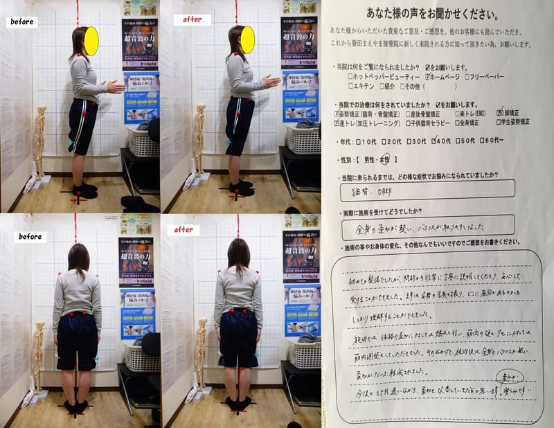 猫背,O脚　O脚矯正姿勢速圧プログラムモニター