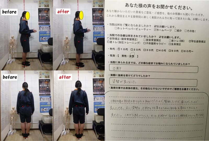 Ｏ脚と姿勢,扁平足が気になる　Ｏ脚矯正姿勢速圧プログラムモニター