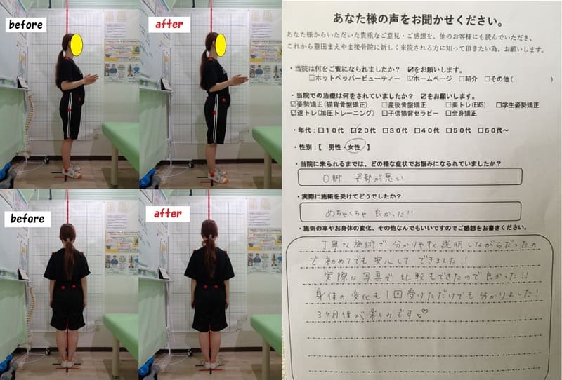 20代女性　（初回モニター）Ｏ脚矯正姿勢速圧プログラム